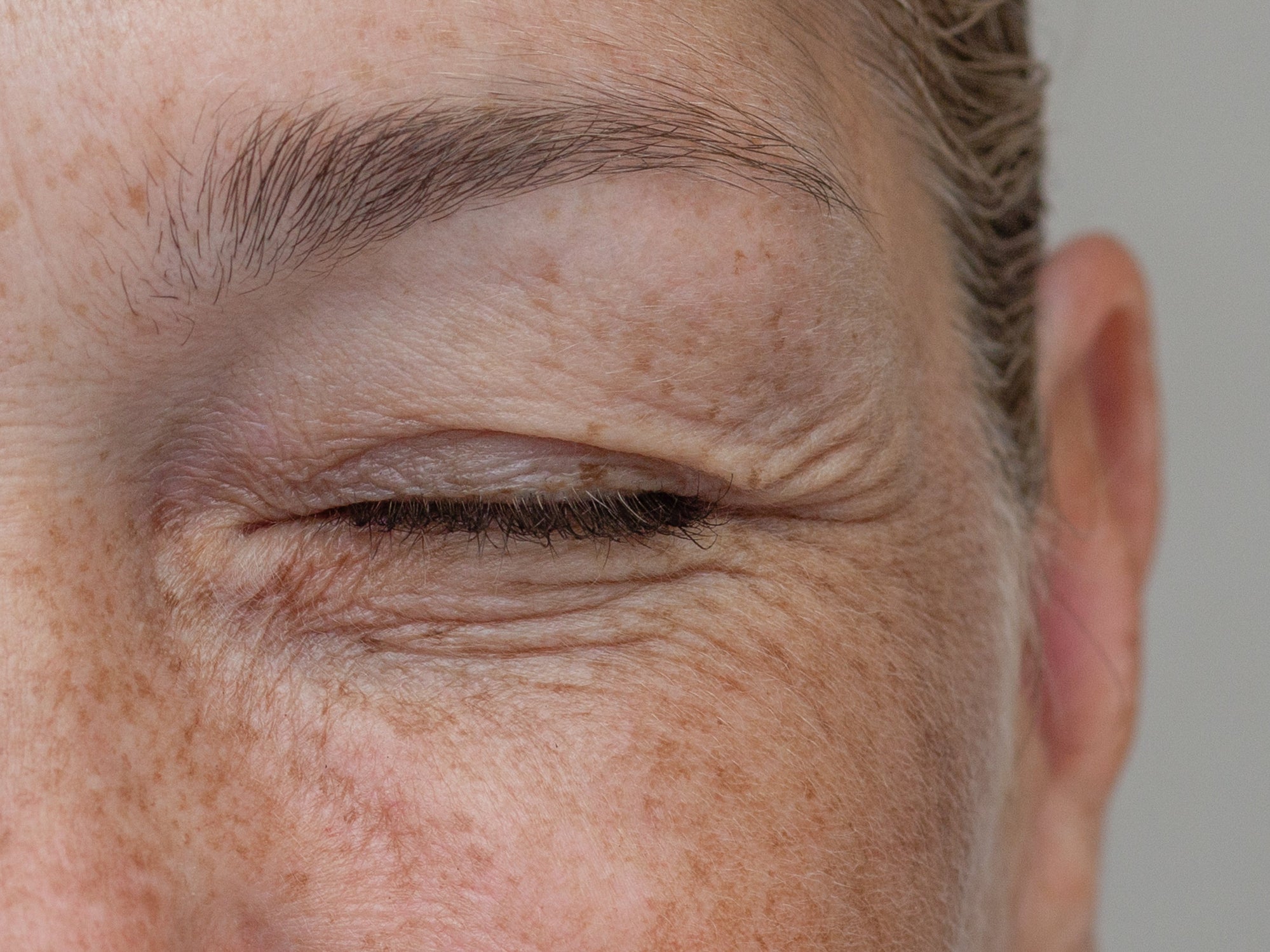 Ageing & Fine Lines